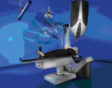 Figure 4: The CyberKnife® uses a plastic mask for patient immobilization. Figure 4: The CyberKnife® uses a plastic mask for patient immobilization.